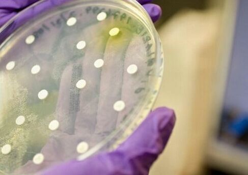 bakterinė kultūra prostatito diagnozei